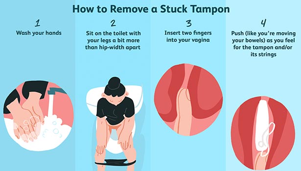 menopause, how to remove tampons, periods, tampons using, tampons removing, மாதவிடாய், மாதவிடாய் நேர உறிப்பஞ்சு, மாதவிடாய் நேர உறிபஞ்சு அகற்றுதல்,